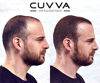 Picture of CUVVA Hair Fibers for Thinning Hair (BLACK) - Keratin Hair Building Fiber Hair Loss Concealer - Thicker Hair in 15 Seconds - 25g/0.87oz Bottle - For Men & Women