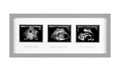 Picture of Pearhead Triple Sonogram Pregnancy Keepsake Frame, Ultrasound Growth Milestone Frame, Gray