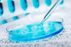 Picture of 20 Pack Sterile Plastic Petri Dishes with Lid, 90mm Dia x 15mm Deep with 20 Plastic Transfer Pipettes (10Pcs3ml,10Pcs2ml) (90MM)