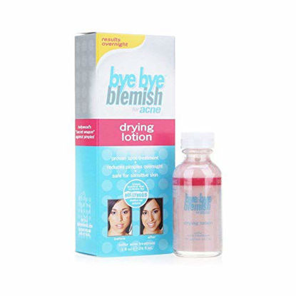 Picture of Bye Bye Blemish for Acne Drying Lotion 1 oz