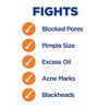 Picture of Clearasil Stubborn Acne Control 5in1 Exfoliating Wash 6.78 fl. oz., Reduces Blocked Pores, Pimple Size, Excess Oil, Acne Marks, Blackheads