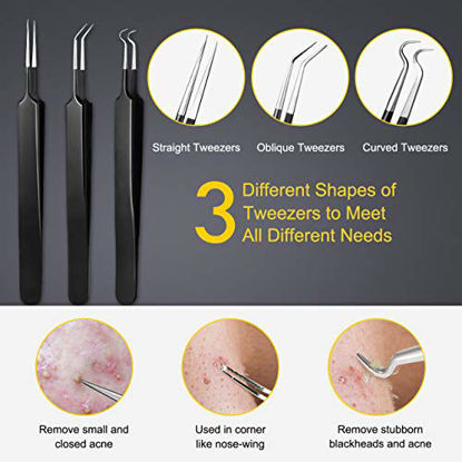 Picture of Pimple Popper Tool Kit - Boxoyx 10 Pcs Blackhead Remover Comedone Extractor Kit with Metal Case for Quick and Easy Removal of Pimples, Blackheads, Zit Removing, Forehead,Facial and NoseBlack)