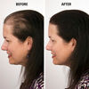Picture of Infinity Hair Fiber - Hair Loss Concealer - Hair Thickening Fiber for Men & Women - Grey,30g