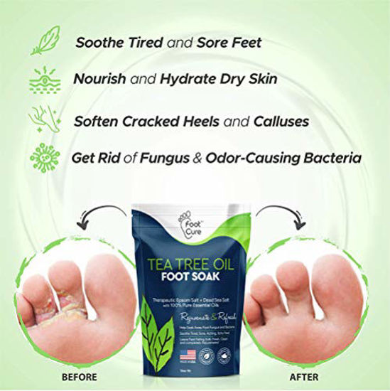 Callus Remover Gel & Pumice Stone Set for Feet & Pedicure – DailyRemedyStore