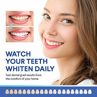 Picture of LUELLI Teeth Whitening Kit - 5X LED Light Tooth Whitener, 12ml with light