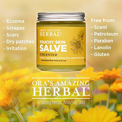 Picture of Touchy Skin Salve, Eczema Cream For Adults and Kids, Eczema Treatment, Calendula Cream, Dermatitis, Dry Hands, Calendula Ointment, Healing Ointment, Oras Amazing Herbal