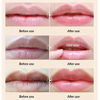 Picture of Lip Masks 20 Pcs, Lip Mask for Dry Lip, Lip Mask Sheets, Collagen Lip Mask Skin Care, Crystal Lip Pads For Moisturizing, Anti-Wrinkle, Anti-Aging, Firms & Hydrates Lips, Lip Sleep Mask Pink