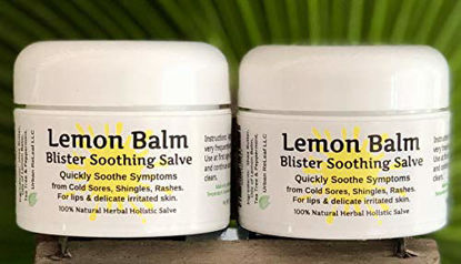 Picture of Urban ReLeaf Lemon Balm Cold Sore & Shingles Salve! 1 Oz, Quickly Soothe Blisters, Rashes, Bumps, Bug Bites, Chicken Pox. Suppress outbreaks. 100% Natural"Goodbye, Itchy red Bumps!" (2)