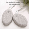 Picture of 2PCS Natural Pumice Stone for Feet, HOOMBOOM Lava Pedicure Tools Hard Skin Callus Remover for Men/Women Feet and Hands - Natural Foot File Exfoliation to Remove Dead Skin