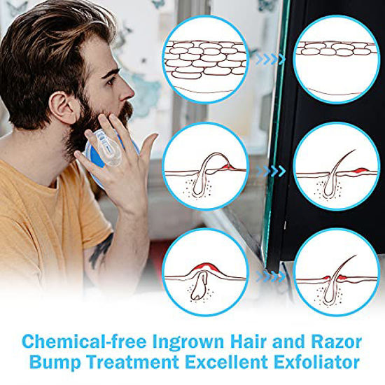 GetUSCart- Exfoliating Brush for Treating Ingrown Hairs and Razor Bump ...