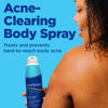 Picture of Acne Body Spray by the makers of Differin Gel, Acne Treatment with Salicylic Acid, 360 Formula for Back Acne, Chest and Shoulders, 6 Oz.