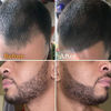 Picture of Beard Pen Filler - Dark Brown 1 Pack - Barber Styling Pencil with Brush - Waterproof Proof, Sweat Proof, Long Lasting Solution, Natural Finish - Cover Facial Hair and Scalp Patches Like a Pro