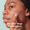 Picture of Mighty Patch Micropoint for Blemishes from Hero Cosmetics - Hydrocolloid Acne Spot Treatment Patch for Early Stage Zits and Hidden Pimples, 395 Proprietary Micropoints (8 Patches)