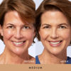 Picture of LAURA GELLER NEW YORK Award-Winning Baked Balance-n-Brighten To Go Color Correcting Powder Foundation - Medium - Buildable Light to Medium Coverage - Demi-Matte Natural Finish