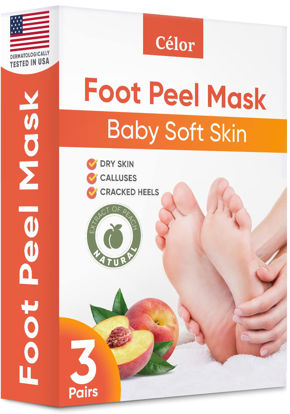 Lavinso Foot Peel Mask for Dry Cracked Feet – 2 Pack Dead Skin Remover and  Callus - Exfoliating Peeling Soft Baby Feet, Original Scent