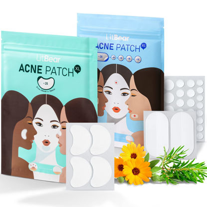 Picture of LitBear Acne Pimple Patches, 6 Sizes 100 Patches for Zit Breakouts, Large Acne Patches for Face, Chin, or Body, Acne Spot Treatment with Tea Tree & Calendula Oil, Hydrocolloid Bandages for Acne Skin