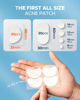 Picture of LitBear Acne Pimple Patches, 6 Sizes 100 Patches for Zit Breakouts, Large Acne Patches for Face, Chin, or Body, Acne Spot Treatment with Tea Tree & Calendula Oil, Hydrocolloid Bandages for Acne Skin