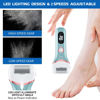 Picture of Electric Foot Callus Remover, Rechargeable Portable Electronic Foot File Pedicure Kits, Waterproof Foot Scrubber File, Professional Pedicure Tools, Foot Care for Dead Skin Ideal Gift, 3 Rollers