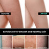 Picture of Dermasuri Deep Exfoliating Mitt Body Scrub - Exfoliating Glove Body Scrubber & Skin Cleanser - Body Scrub Gloves for Women & Men - Skin Exfoliator for Body Tool Remover of Dead & Dry Skin Pack of 2