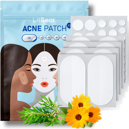Picture of LitBear Acne Pimple Patches, 5 Sizes 80 Patches for Large Zit Breakouts, Face, Chin or Body, Spot Treatment with Tea Tree & Calendula Oil, Hydrocolloid Bandages Skin