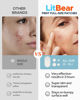 Picture of LitBear Acne Pimple Patches, 5 Sizes 80 Patches for Large Zit Breakouts, Face, Chin or Body, Spot Treatment with Tea Tree & Calendula Oil, Hydrocolloid Bandages Skin