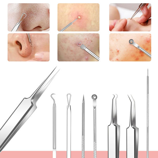 GetUSCart- Stainless Steel Pimple Popper Tool Kit Whitehead Blemish Removal  Tool