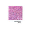 Picture of Hemway Premium Ultra Sparkle Glitter Multi Purpose Metallic Flake for Arts Crafts Nails Cosmetics Resin Festival Face Hair - Pink Holographic - Chunky (1/40" 0.025" 0.6mm) 100g / 3.5oz