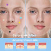 Picture of Daolyo Pimple Patches for Face, 3 Size 280 Counts Acne Patches, Cute Star Pimple Patches with Salicylic Acid, Tea Tree Oil & Calendula Oil, Colorful Hydrocolloid Patches Zit Patches Pimple Stickers