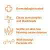 Picture of Amazon Basics Acne Cream Cleanser with 4% Benzoyl Peroxide, 5 Fluid Ounces, 1-Pack