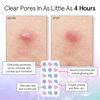 Picture of grace & stella Pimple Patches For Face (Multishape, 36 Count) - Hydrocolloid Acne Patches for Face - Dermatologist Tested, Vegan, Cruelty-Free Zit Patches for Face, Blemish Patches, Pimple Stickers