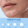Picture of Daolyo Pimple Patches for Face, 4 Size 300 Counts Acne Patches, Hydrocolloid Patches for Covering Zits and Blemishes, Spot Stickers with Salicylic Acid, Tea Tree Oil & Calendula Oil