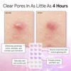 Picture of grace & stella Pimple Patches For Face (Heart, 72 Count) - Hydrocolloid Acne Patches for Face - Dermatologist Tested, Vegan, Cruelty-Free Zit Patches for Face, Blemish Patches, Pimple Stickers