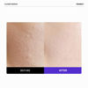 Picture of Frankly Closer Serum - Pore Minimizing, Anti-Aging, Elasticity, Hydration, Plump & Dewy Skin |9 Peptides, Vegan Collagen, PHA |Non-comedogenic & Derm Tested Korean Skincare |All skin types |2.03 fl.oz