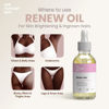 Picture of Her Fantasy Box | Renew Her - Natural Rejuvenating Oil for Dark Spots and Ingrown Hair