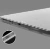 Picture of Speaker Mesh Anti Dust Proof Metal Guard Earpiece Mesh Dust Cover for iPad Pro 11-inch 13-inch,iPad Air 6 2024, Air 5, Mini 6,Pro 12.9,Air 4 (2 Sets/Black)