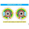 Picture of Multi-Function Iris Analyzer Iridology Camera, Usb Computer-Specific Iris Analysis Camera, With Aluminum Box + Hd 13 Million Pixel + Iris Analysis Software, For Beauty Salon, Spa
