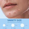 Picture of Daolyo Pimple Patches for Face, 3 Size 510 Counts Hydrocolloid Acne Patches for Covering Zits and Blemishes, Spot Stickers with Salicylic Acid, Tea Tree Oil & Calendula Oil(8mm,10mm,12mm)