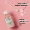 Picture of Mario Badescu Drying Duo, Includes Drying Lotion Blemish Spot Treatment with Salicylic Acid and Sulfur (1 Fl Oz) and Drying Patch Facial Stickers, Invisible Pimple Patches (60 Count)