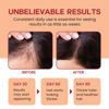 Picture of Lebanta Raw Batana Oil for Hair Growth - 100% Pure, Organic 4oz Batana from Honduras for Thick and Strong Natural Hair - Dr. Sebi Unrefined Cold Pressed Cosmetic Scalp Mask for Men & Women (1 Pack)