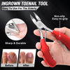 Picture of Podiatrist Toenail Clippers for Seniors Thick Toenails, Professional Pedicure Tools Kit, Toe Nail Clippers Adult Thick Nails Long Handle, Ingrown Toenail Tool Removal Kit for Seniors, Men, Pedicure