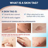 Picture of Claritag Advanced Skin Tag Remover - FDA-Cleared Device - Only for Skin Tag Removal - Works in 7-14 Days - Up to 10 Treatment Cycles - Cryogenic Freeze-Off Kit