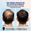 Picture of Taro Minoxidil Topical Aerosol Foam, 5%, Hair Regrowth 4 Months Treatment for Men, 2.11 oz (4 Pack)