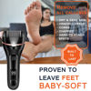 Picture of Callus Remover for Feet, 13-in-1 Professional Pedicure Tools Foot Care Kit, Foot Scrubber Electric Feet File Pedi for Hard Cracked Dry Dead Skin, 3 Rollers, 2 Speed, Battery Display (Black)