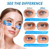 Picture of Onespring Eye Gel Pads (24 Pairs) - Under Eye Patches for Puffy Eyes, Wrinkles, Dark Circles, Natural Collagen Eye Gels, Under Eye Mask Patches for Face to Soothe Puffiness, Eye Bags