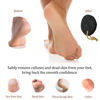 Picture of Pumice Stone - Natural Earth Lava Black - Callus/Corn Remover for Feet Heels and Palm - Pedicure Exfoliation Tool - Dry Dead Skin Scrubber - Health Foot Care