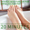 Picture of SULADEC Moisturizing Foot Mask with Shea Butter and Goat Milk, Hydrating Foot Masks for Dry Cracked Feet, Dry Skin Moisturizer for Soft and Smooth Touch Feet - Men Women - 5 Pairs