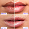 Picture of Wonderskin Lip Oil - Lip Rehab Serum Oil, Hydrating and Moisturizing Clear Serum for Dry Lips - Natural, Vegan and Non-sticky (Clear)