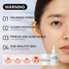 Picture of LANBENA 3-in-1 Blackhead Removal Set - Pore Strips (30g), Pore Minimizing Serum (30ml) & Removal Paper - Mask for Face, Minimizes Pores & Leaves Skin Fresh & Clean, Blackhead Remover