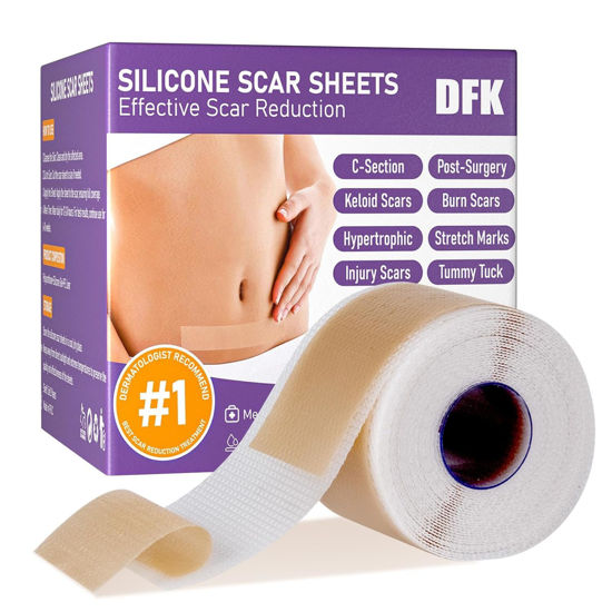 Picture of Silicone Scar Sheets, Silicone Scar Tape(1.6"x 118" Roll-3M), Reusable Professional Scar Silicone Strips, Soft Silicone Scar Sheets for Surgical Scars,Keloid,Acne Scars,Burn Scar,C-Section