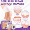 Picture of Silicone Scar Sheets, Silicone Scar Tape(1.6"x 118" Roll-3M), Reusable Professional Scar Silicone Strips, Soft Silicone Scar Sheets for Surgical Scars,Keloid,Acne Scars,Burn Scar,C-Section